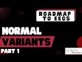 Roadmap to EEGs: Normal Variants Part 1