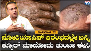 Vedam Hospital : ಸೋರಿಯಾಸಿಸ್ ಆರಂಭದಲ್ಲೇ ಬನ್ನಿ, ಕ್ಯೂರ್ ಮಾಡೋದು ತುಂಬಾ ಈಸಿ| National TV