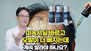 탈모치료 미녹시딜 바르고 모발이 더 빠지는 쉐딩현상 걱정하지 마세요.