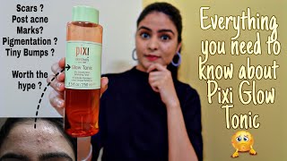 How to use Pixi Glow Tonic ? Chemical Exfoliation Tips | Kashika Chauhan