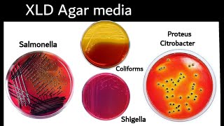 XLD agar : Xylose Lysine Deoxycholate Agar: isolation of Salmonella Bacteria - Microbiology