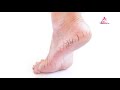 pitha vedipu poga how to cure cracked heels கால் பித்த வெடிப்பு குணமாக இதை மட்டும் செய்தால் போதும்