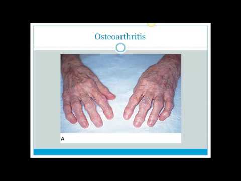 What are some diseases that affect the skeletal system?