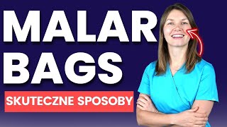 Malar Bags – Jakie Skuteczne Zabiegi Polecam? DOMOWE SPOSOBY! | Lekarz Wyjaśnia