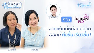 รีวิว Thermage FLX แก้แก้มหย่อน หน้าย้อย ให้หน้าตึง ยกกระชับ | มั่นใจไปกับ V Square Clinic