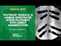 Posterior Thoracic & Lumbar Fenestrated Screw Placement with Cement Augmentation - Rod Oskouian, MD