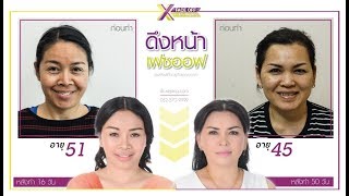 ดึงหน้า เฟซออฟ : ส่องกระจกแล้วไม่สวย รีบตัดสินใจทำเฟซออฟ หมดความทุกข์ ยิ้มรับความสุขที่ปลอดภัย