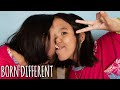The Incredible Conjoined Twins Attached At The Head | BORN DIFFERENT