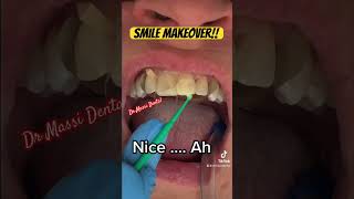 Smile Makeover!!