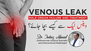 Venous Leak: Male Organ Failure and treatment