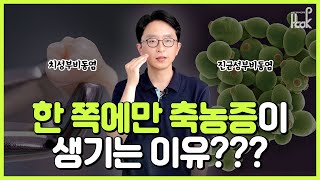 [HOOK] 축농증 한 쪽에만 생기는 이유가 이런거라고?