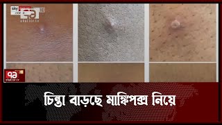 আরও তিন দেশে মাঙ্কিপক্স শনাক্ত | Monkeypox | News | Ekattor TV