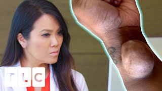 Dr. Lee Meets A Woman With A Very Mysterious Arm Growth | Dr. Pimple Popper: Before The Pop