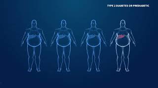 Learn about Comorbidities