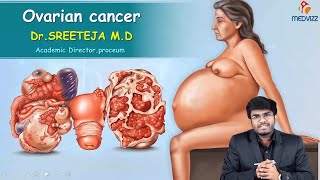 Ovarian Cancer Part 1 : Obstetrics and gynaecology Video lectures
