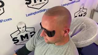 Scalp Micropigmentation | SMP | Kentucky, Ohio, Tennessee, Indiana