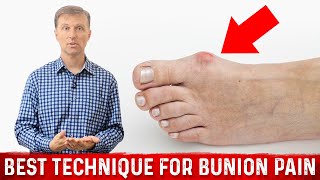 Bunion Pain Relief – The Simple \u0026 Best Technique by Dr.Berg