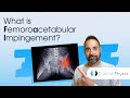 What is Femoroacetabular Impingement? | Expert Physio Review