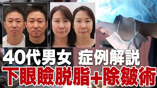 40代男女 下眼瞼脱脂+除皺術症例解説