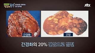 침묵의 장기 '간'의 변화 과정 '섬뜩' 건강의 품격 30회