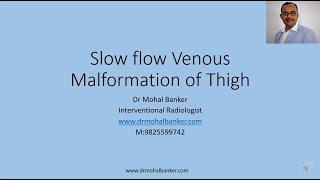 Venous slow flow malformation of thigh (Hindi)