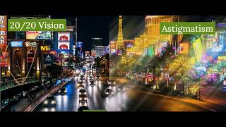 What Is Astigmatism? Explained by an Eye Doctor