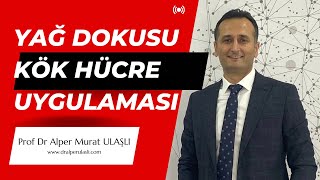 Diz eklemine yağ dokusu kök hücre uygulaması