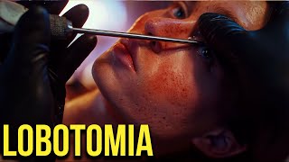 LOBOTOMIA - La BRUTALE CHIRURGIA utilizzata per trattare le MALATTIE MENTALI