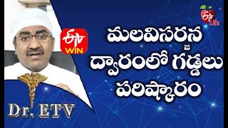 Rectal Prolapse | మలవిసర్జన ద్వారంలో గడ్డలు -పరిష్కారం | Dr.ETV | 14th January 2021| ETV Life