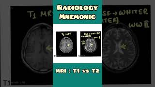 T1 vs T2 MRI - mnemonic | Radiology | #shorts