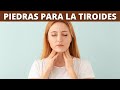 LOS MEJORES CRISTALES Y PIEDRAS PRECIOSAS PARA LA TIROIDES Y LA ANSIEDAD