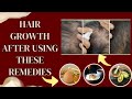 3 DIY Hair Masks for Healthy Hair | Homemade hair mask for hair #DIYHairMasks #HomemadeHairMask