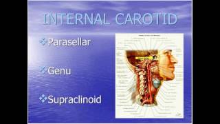 Natus TCD Webinar: Transcranial Doppler and Collateral Flow Patterns