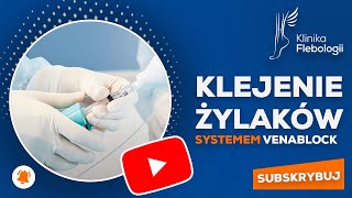 Klejenie żylaków systemem VenaBlock (Klinika Flebologii w Warszawie)