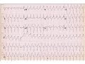 ECG quiz, Dr. Sherif Altoukhy