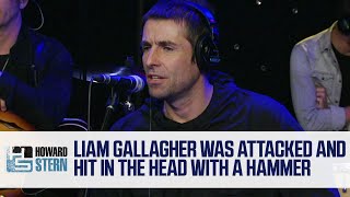 How a Head Injury Led Liam Gallagher Into Music (2017)