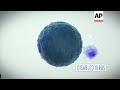 US clears first 'living drug' for tough childhood leukemia ++ Animation++