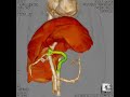 犬の門脈体循環シャント（ct3d動画①）＿松波動物病院メディカルセンター