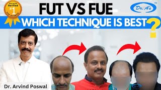 Hair Transplant in India | Best Results & cost of Hair Transplant in India
