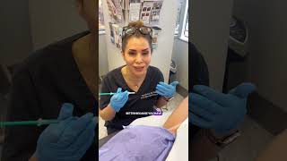 Bye Sweaty Armpits!💦Botox for Hyperhidrosis Explained #shorts