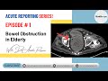 Bowel Obstruction in Elderly, Episode # 1, Acute Reporting Series