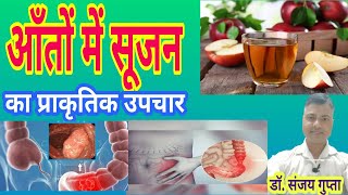 आंतो में सूजन का प्राकृतिक उपचार । natural remedies for inflammatory bowel disease । Dr.Sanjay Gupta