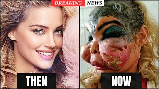 Famous Celebrities Unrecognizable After Plastic Surgery Gone Wrong | Then and Now 2026