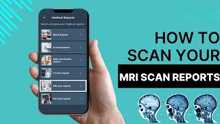 How to Scan and Store MRI Scan Reports in Medugo App?