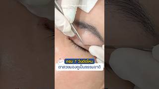 ครบ 7 วันตัดไหม ตาสวยมองดูเป็นธรรมชาติ #inzclinic #inZeye #ศัลยกรรมตา #จักษุแพทย์ #ทำตาสองชั้น