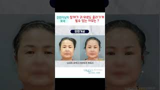 안면거상 절개가 귀위로도 올라가게 될수 있는이유는? #안면거상절개 #안면거상내시경 #안면거상팔자주름