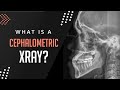 What is a Cephalometric Xray? https://www.straightsmilesolutions.com/