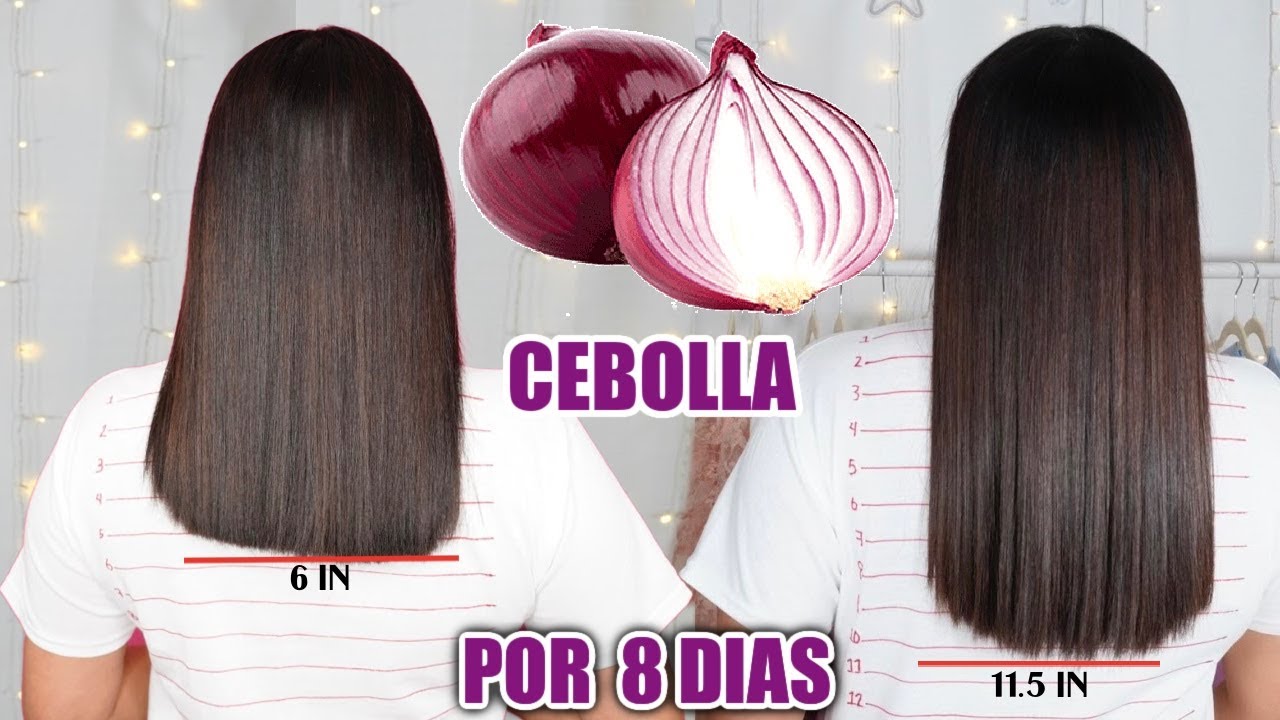 RETO#3 CEBOLLA PARA HACER CRECER EL CABELLO Y DETENER LA CAIDA EN 8 ...