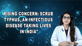 Rising Concern: Scrub Typhus, an Infectious Disease Taking Lives in India