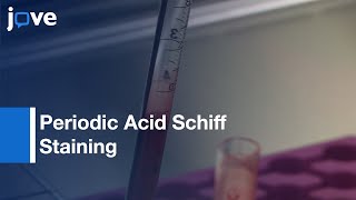 Periodic Acid Schiff Staining for Detecting Glycogen in PBMCs | Protocol Preview